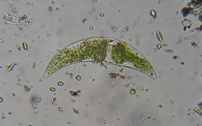 Closterium, a crescent shaped green alga, under the microscope