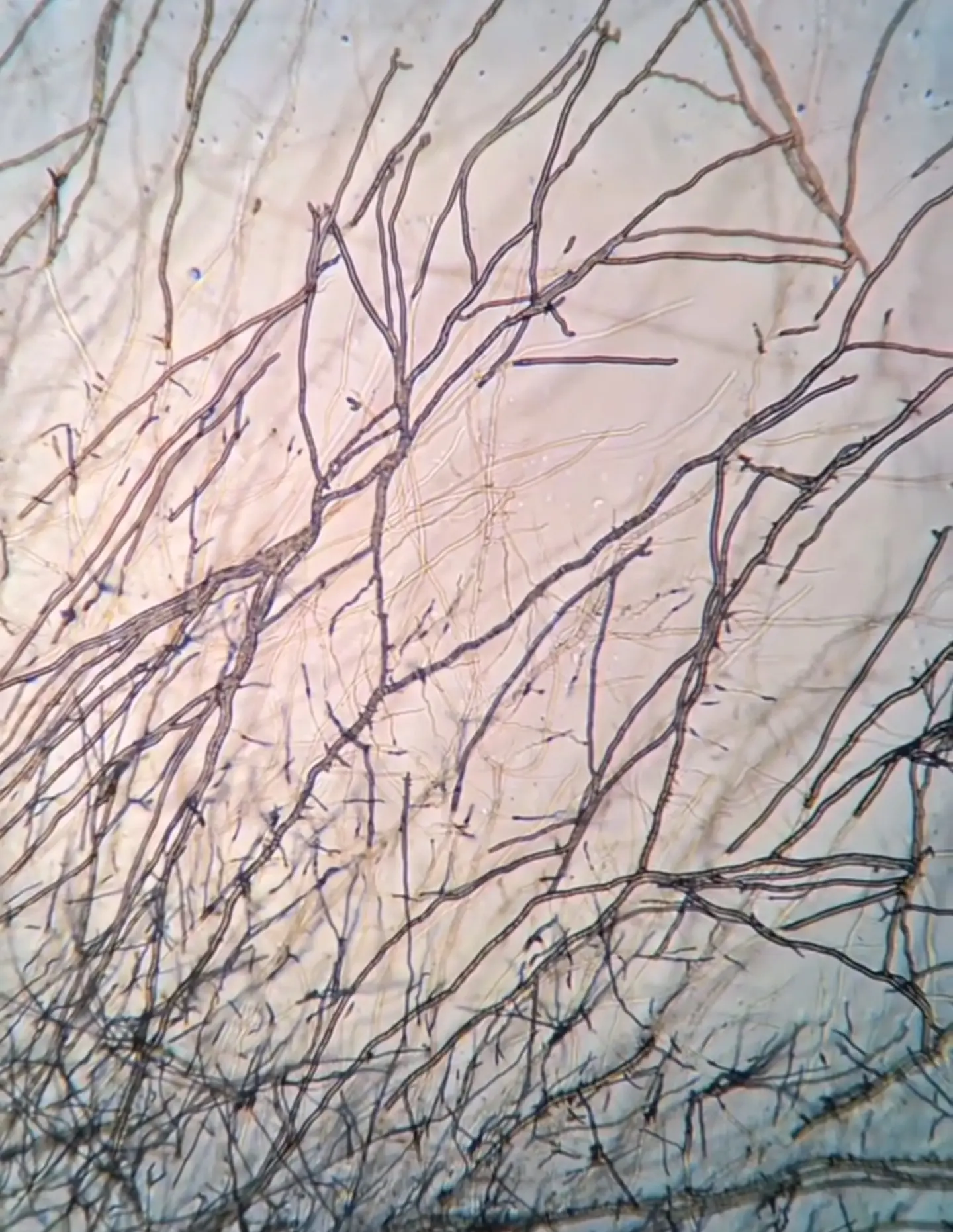 Microscopic diagram of the Mycoloop