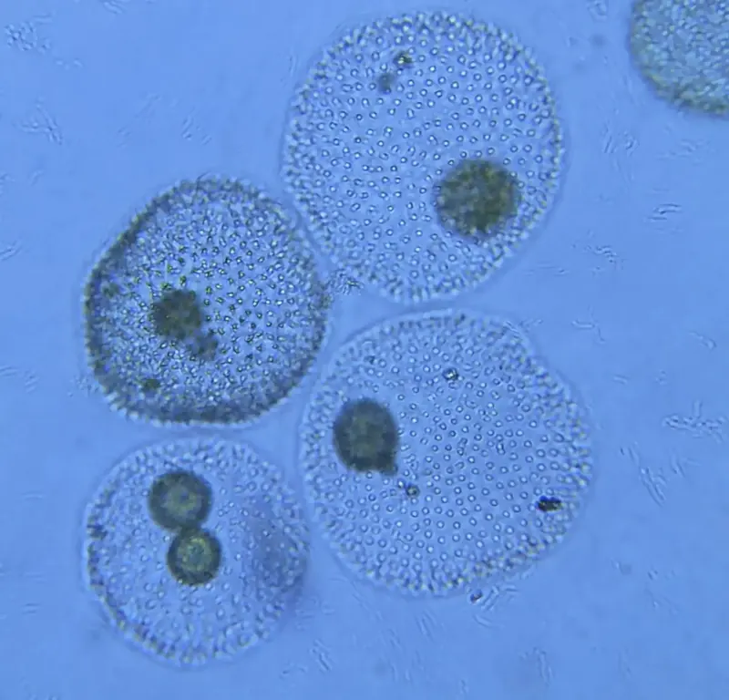 Volvox colonies under the microscope